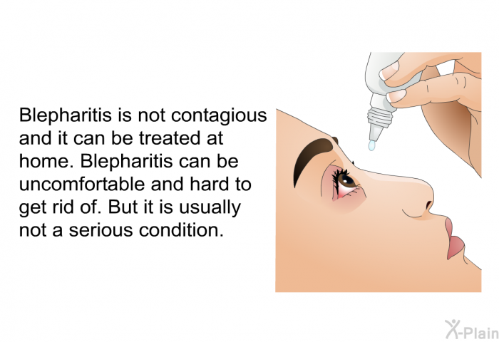 Blepharitis is not contagious and it can be treated at home. Blepharitis can be uncomfortable and hard to get rid of. But it is usually not a serious condition.