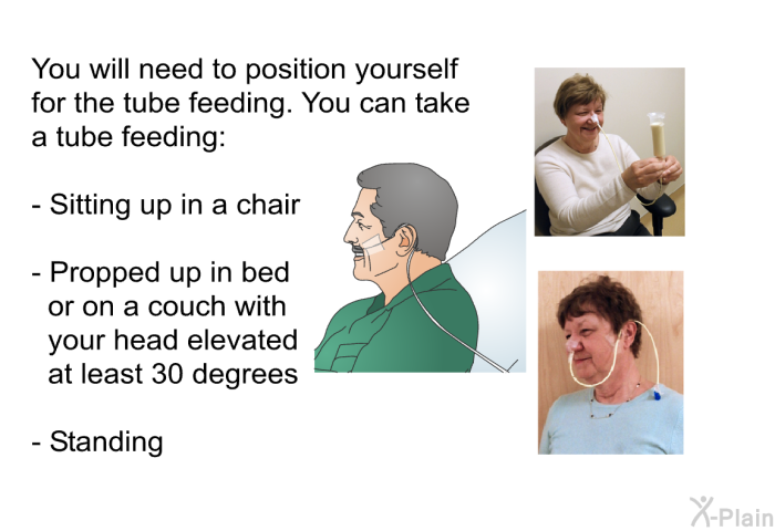 You will need to position yourself for the tube feeding. You can take a tube feeding:  Sitting up in a chair Propped up in bed or on a couch with your head elevated at least 30 degrees Standing