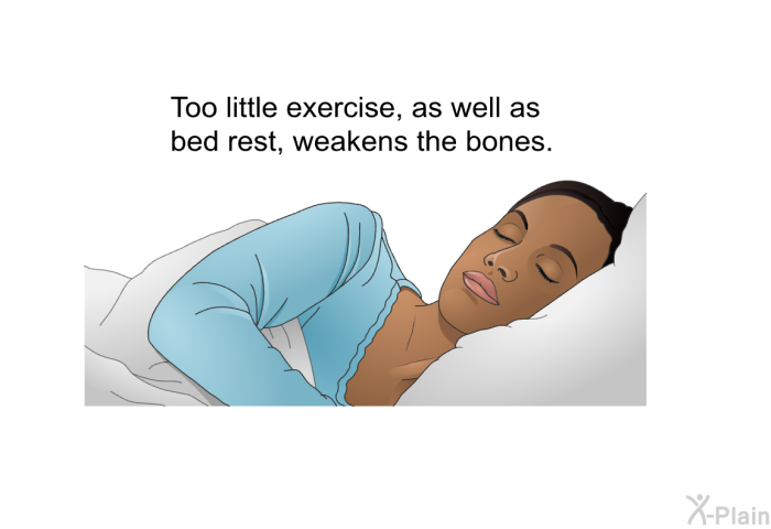 Too little exercise, as well as bed rest, weakens the bones.