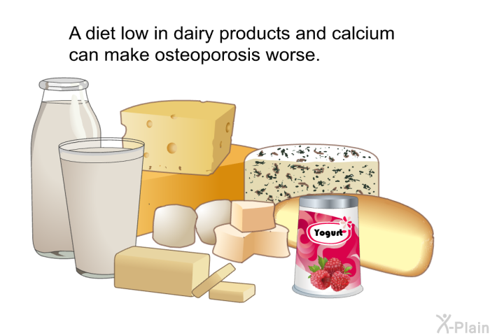 A diet low in dairy products and calcium can make osteoporosis worse.