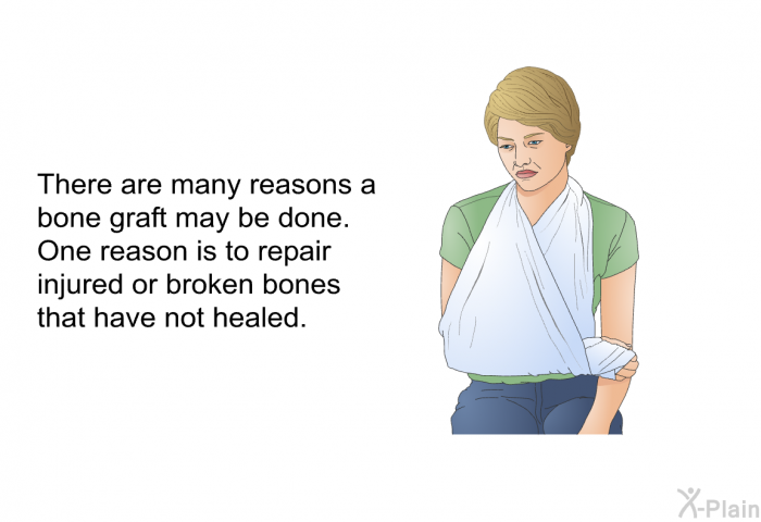There are many reasons a bone graft may be done. One reason is to repair injured or broken bones that have not healed.