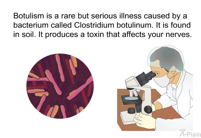 Botulism is a rare but serious illness caused by a bacterium called Clostridium botulinum. It is found in soil. It produces a toxin that affects your nerves.
