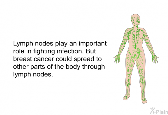 Lymph nodes play an important role in fighting infection. But breast cancer could spread to other parts of the body through lymph nodes.