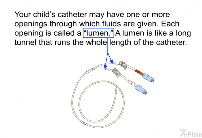 Your child's catheter may have one or more openings through which fluids are given. Each opening is called a “lumen.” A lumen is like a long tunnel that runs the whole length of the catheter.