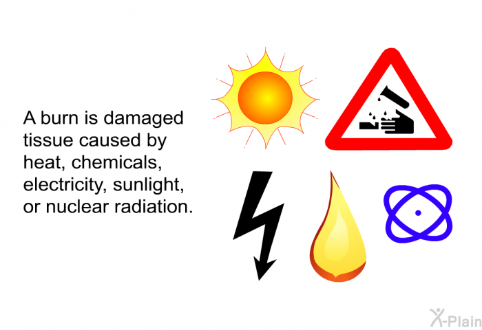 A burn is damaged tissue caused by heat, chemicals, electricity, sunlight or nuclear radiation.