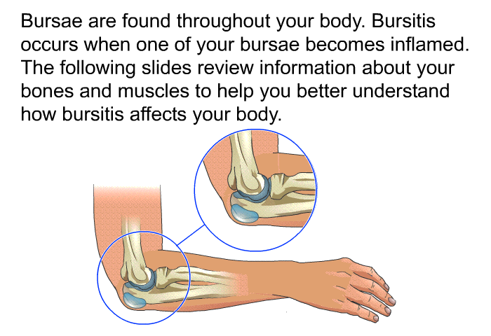 Bursae are found throughout your body. Bursitis occurs when one of your bursae becomes inflamed. The following slides review information about your bones and muscles to help you better understand how bursitis affects your body.