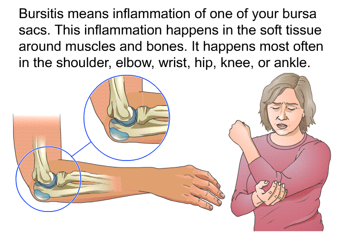 Bursitis means inflammation of one of your bursa sacs. This inflammation happens in the soft tissue around muscles and bones. It happens most often in the shoulder, elbow, wrist, hip, knee, or ankle.