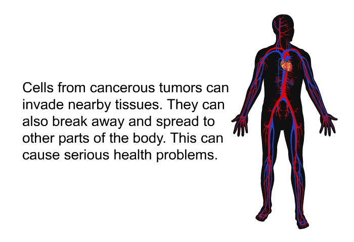 Cells from cancerous tumors can invade nearby tissues. They can also break away and spread to other parts of the body. This can cause serious health problems.