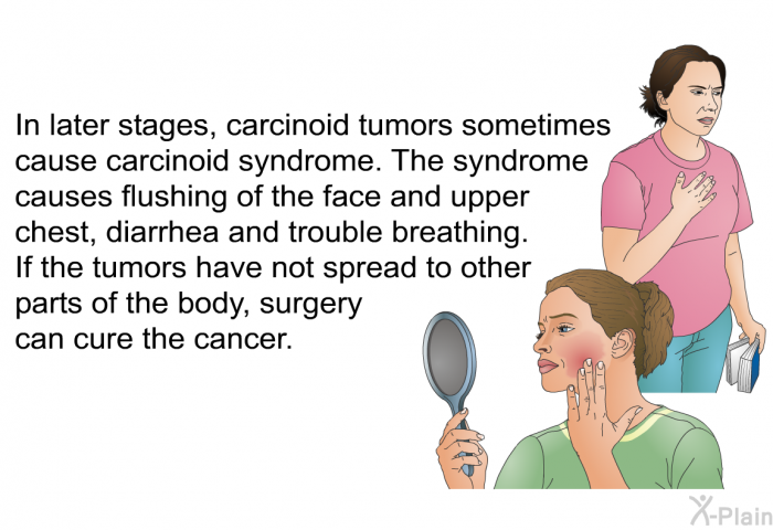 In later stages, carcinoid tumors sometimes cause carcinoid syndrome. The syndrome causes flushing of the face and upper chest, diarrhea and trouble breathing. If the tumors have not spread to other parts of the body, surgery can cure the cancer.