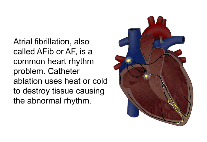 atrial fibrillation animation
