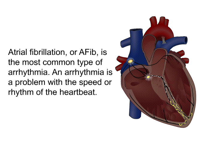 Atrial fibrillation, or AFib, is the most common type of arrhythmia. An arrhythmia is a problem with the speed or rhythm of the heartbeat.