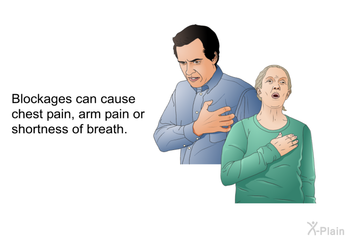 Blockages can cause chest pain, arm pain or shortness of breath.