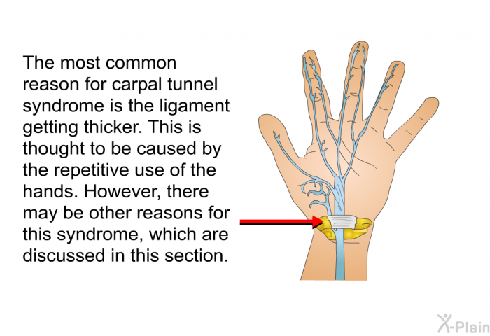 The most common reason for carpal tunnel syndrome is the ligament getting thicker. This is thought to be caused by the repetitive use of the hands. However, there may be other reasons for this syndrome, which are discussed in this section.