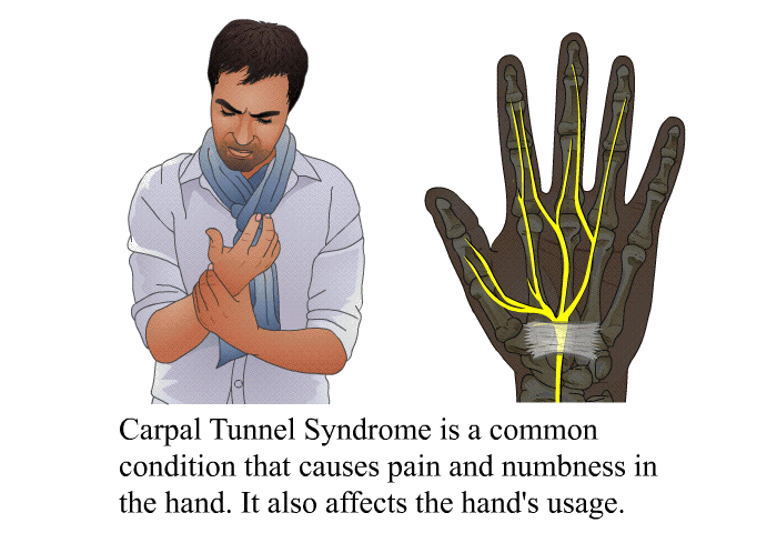 Carpal Tunnel Syndrome is a common condition that causes pain and numbness in the hand. It also affects the hand's usage.