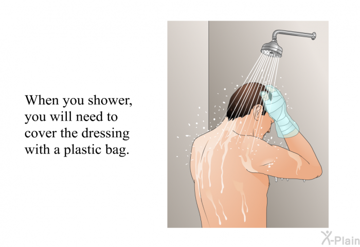 When you shower, you will need to cover the dressing with a plastic bag.