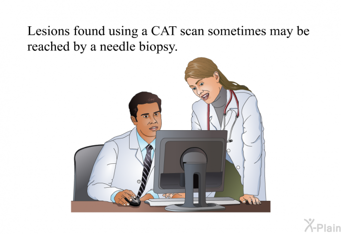 Lesions found using a CAT scan sometimes may be reached by a needle biopsy.