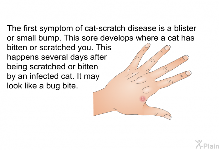 The first symptom of cat-scratch disease is a blister or small bump. This sore develops where a cat has bitten or scratched you. This happens several days after being scratched or bitten by an infected cat. It may look like a bug bite.