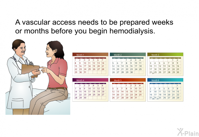 A vascular access needs to be prepared weeks or months before you begin hemodialysis.