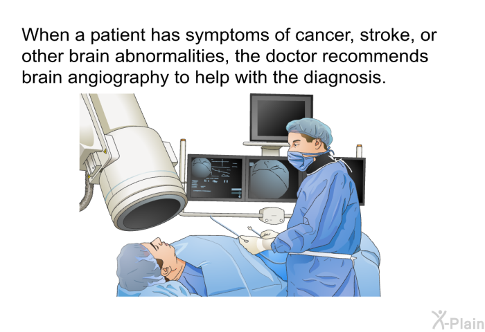 When a patient has symptoms of cancer, stroke, or other brain abnormalities, the doctor recommends brain angiography to help with the diagnosis.