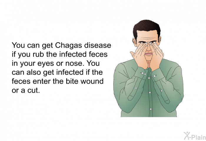 You can get Chagas disease if you rub the infected feces in your eyes or nose. You can also get infected if the feces enter the bite wound or a cut.