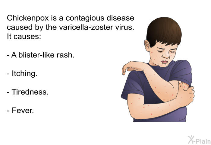 Chickenpox is a contagious disease caused by the varicella-zoster virus. It causes:  A blister-like rash. Itching. Tiredness. Fever.