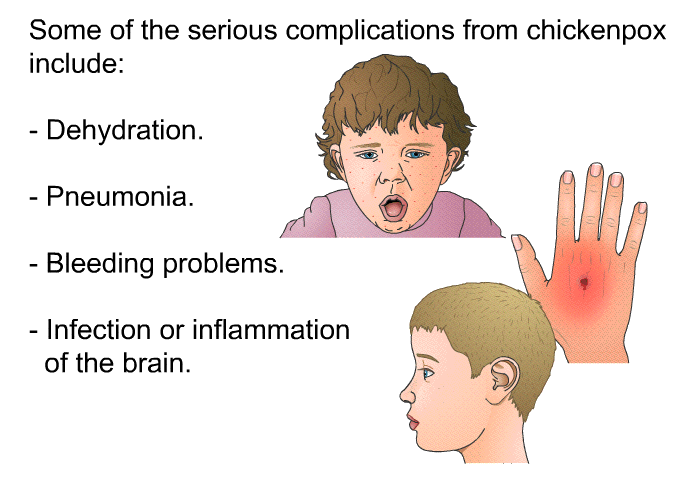 Some of the serious complications from chickenpox include:  Dehydration. Pneumonia. Bleeding problems. Infection or inflammation of the brain.