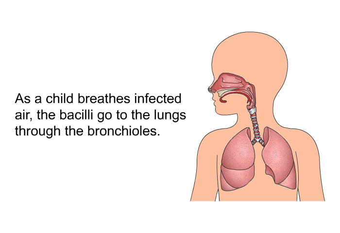 As a child breathes infected air, the bacilli go to the lungs through the bronchioles.