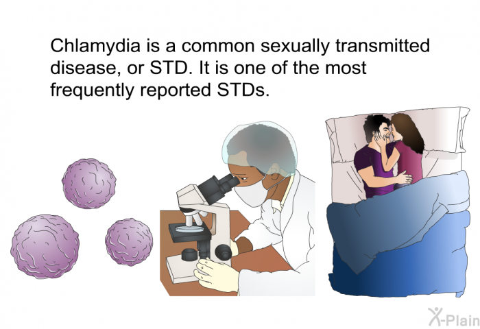 Chlamydia is a common sexually transmitted disease, or STD. It is one of the most frequently reported STDs.