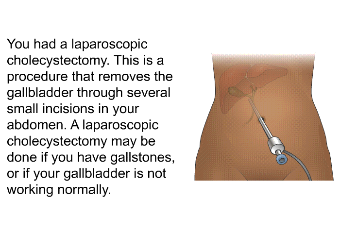 You had a laparoscopic cholecystectomy. This is a procedure that removes the gallbladder through several small incisions in your abdomen. A laparoscopic cholecystectomy may be done if you have gallstones, or if your gallbladder is not working normally.