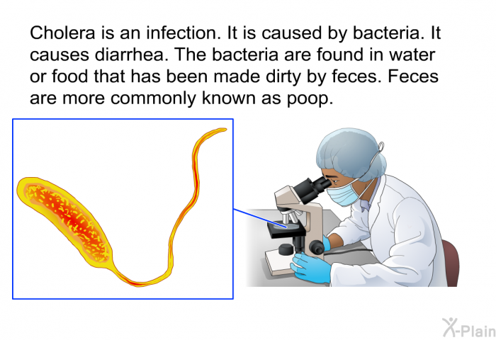 Cholera is an infection. It is caused by bacteria. It causes diarrhea. The bacteria are found in water or food that has been made dirty by feces. Feces are more commonly known as poop.