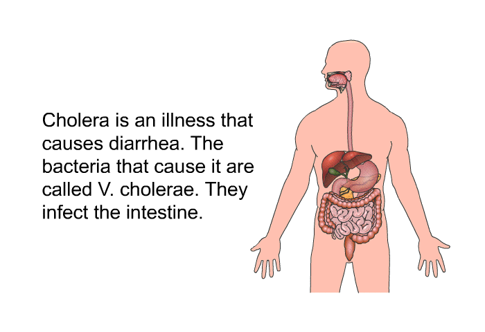 Cholera is an illness that causes diarrhea. The bacteria that cause it are called V. cholerae. They infect the intestine.