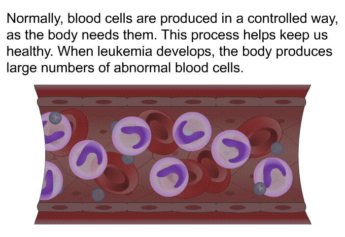 Normally, blood cells are produced in a controlled way, as the body needs them. This process helps keep us healthy. When leukemia develops, the body produces large numbers of abnormal blood cells.