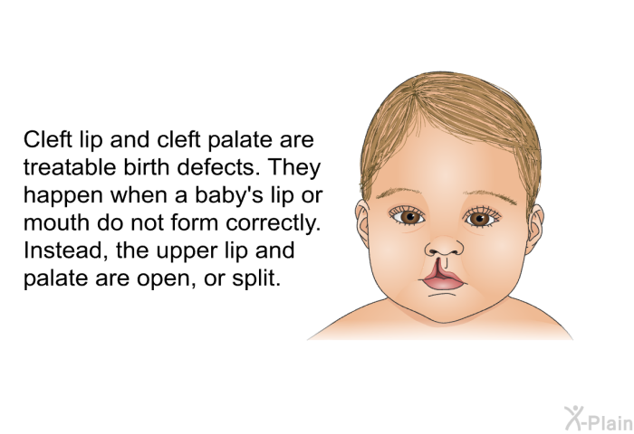Cleft lip and cleft palate are treatable birth defects. They happen when a baby's lip or mouth do not form correctly. Instead, the upper lip and palate are open, or split.
