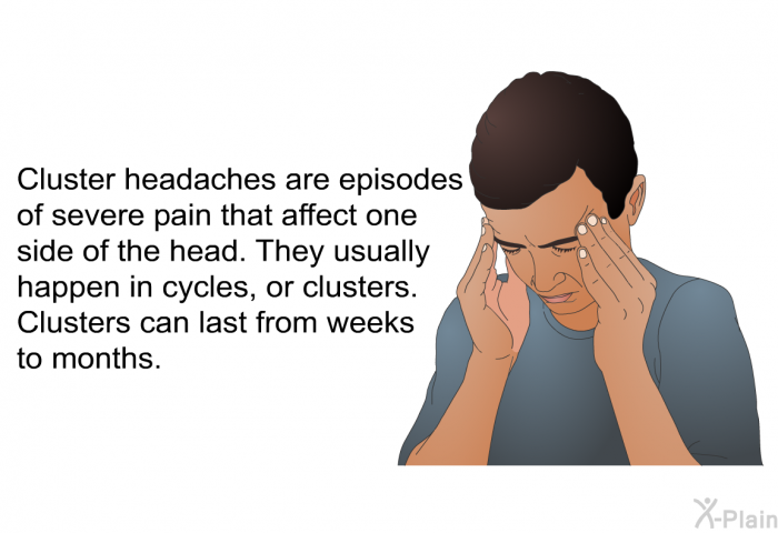 Cluster headaches are episodes of severe pain that affect one side of the head. They usually happen in cycles, or clusters. Clusters can last from weeks to months.