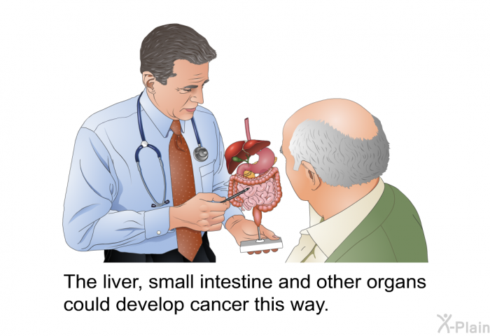 The liver, small intestine and other organs could develop cancer this way.