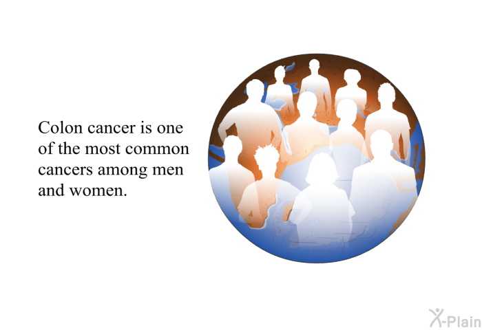 Colon cancer is one of the most common cancers among men and women.