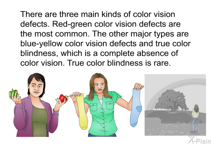 There are three main kinds of color vision defects. Red-green color vision defects are the most common. The other major types are blue-yellow color vision defects and true color blindness, which is a complete absence of color vision. True color blindness is rare.