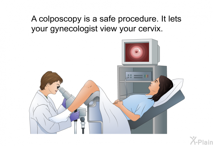 A colposcopy is a safe procedure. It lets your gynecologist view your cervix.