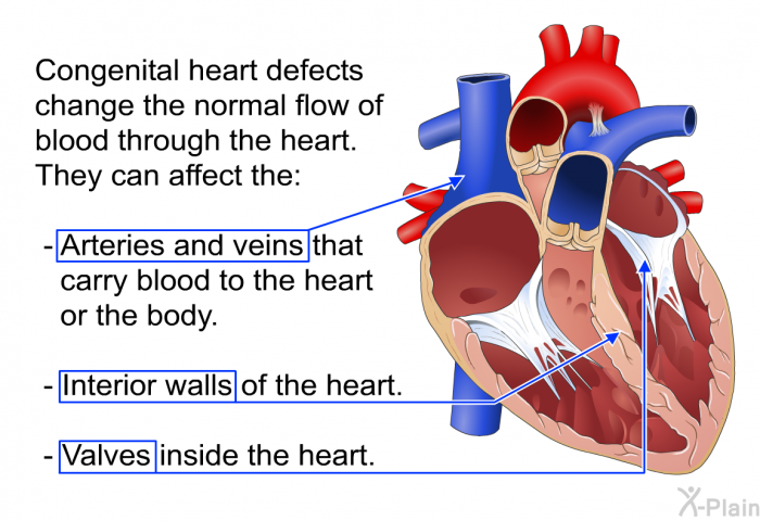 Congenital heart defects change the normal flow of blood through the heart. They can affect the:  Arteries and veins that carry blood to the heart or the body. Interior walls of the heart. Valves inside the heart.