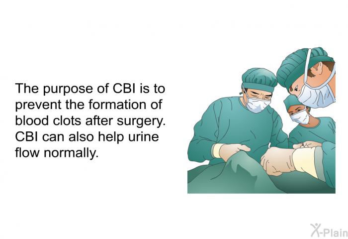 The purpose of CBI is to prevent the formation of blood clots after surgery. CBI can also help urine flow normally.