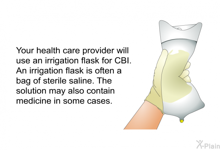 Your health care provider will use an irrigation flask for CBI. An irrigation flask is often a bag of sterile saline. The solution may also contain medicine in some cases.