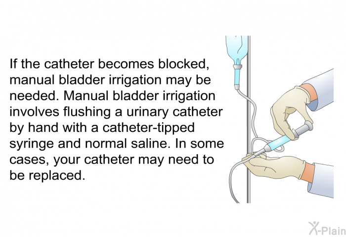 If the catheter becomes blocked, manual bladder irrigation may be needed. Manual bladder irrigation involves flushing a urinary catheter by hand with a catheter-tipped syringe and normal saline. In some cases, your catheter may need to be replaced.