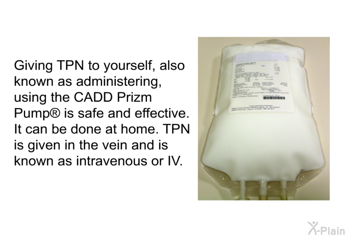 Giving TPN to yourself, also known as administering, using the CADD Prizm Pump  is safe and effective. It can be done at home. TPN is given in the vein and is known as intravenous or IV.