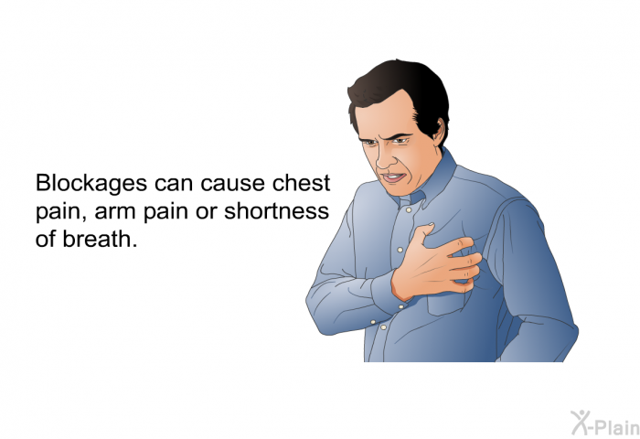 Blockages can cause chest pain, arm pain or shortness of breath.