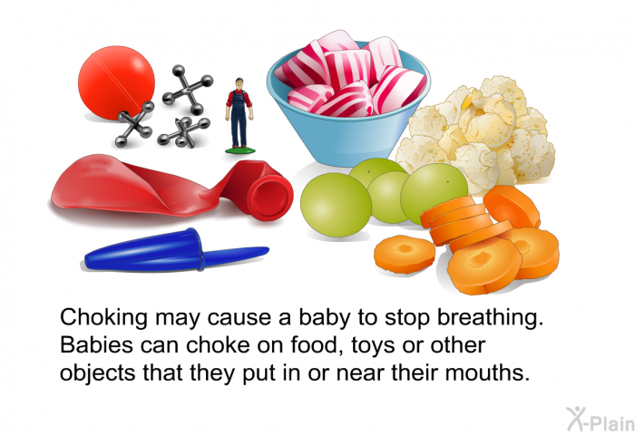 Choking may cause a baby to stop breathing. Babies can choke on food, toys or other objects that they put in or near their mouths.