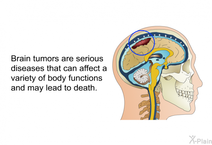Brain tumors are serious diseases that can affect a variety of body functions and may lead to death.
