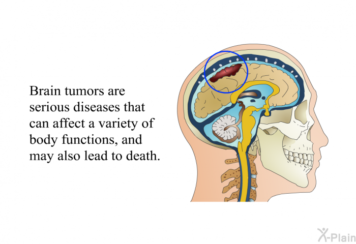 Brain tumors are serious diseases that can affect a variety of body functions, and may also lead to death.