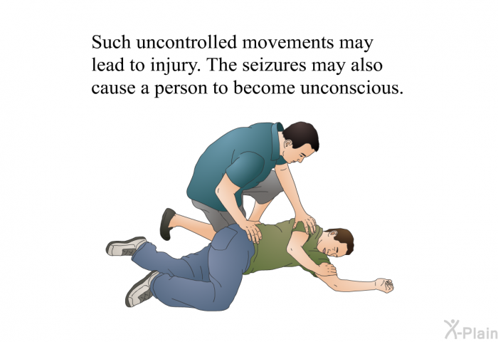 Such uncontrolled movements may lead to injury. The seizures may also cause a person to become unconscious.
