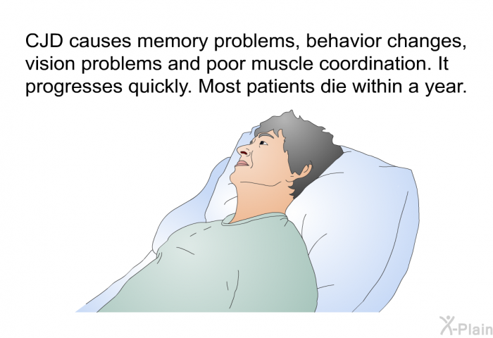 CJD causes memory problems, behavior changes, vision problems and poor muscle coordination. It progresses quickly. Most patients die within a year.