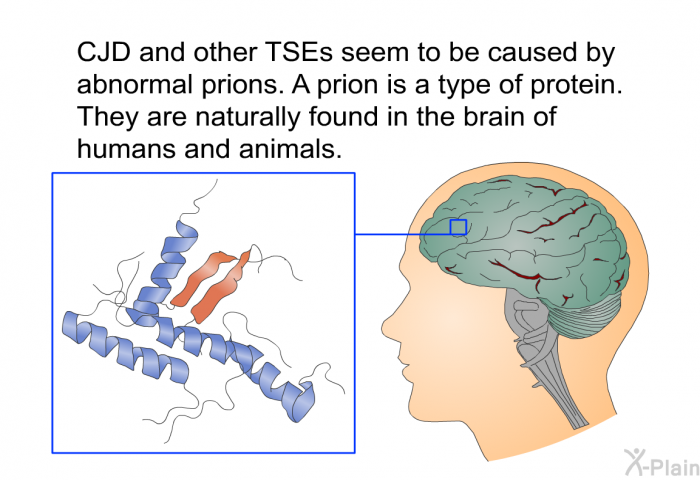 CJD and other TSEs seem to be caused by abnormal prions. A prion is a type of protein. They are naturally found in the brain of humans and animals.